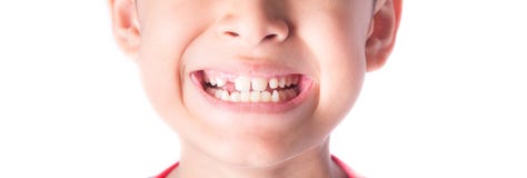Close Up Of Kid Toothless Royalty Free Stock Photography