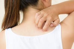 Close up woman hand scratch the itch by hand at neck and back. stock photo Close up woman hand scratch the itch by hand at neck and back. stock photo