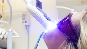 Closeup 4k footage of special UV lamp working during teeth whitening procedure in dentist office stock video Closeup 4k footage of special UV lamp working during teeth whitening procedure in dentist office stock video