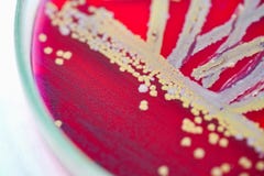 Colony of bacteria in culture medium plate. Stock Photo Colony of bacteria in culture medium plate. Stock Photo