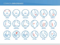 Common skin diseases
