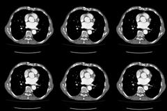 Computertomografiect gehele buik in As Deel tien royalty-vrije stock fotografie Computertomografiect gehele buik in As Deel tien royalty-vrije stock fotografie