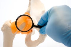 Concept photo of diagnosis of diseases of human hip joint. Doctor holding magnifying glass, inspects of anatomical model of hip an royalty free stock photos Concept photo of diagnosis of diseases of human hip joint. Doctor holding magnifying glass, inspects of anatomical model of hip an royalty free stock photos