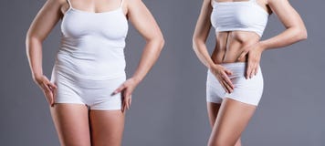 Corpo del ` s della donna prima e dopo perdita di peso su fondo grigio immagine stock Corpo del ` s della donna prima e dopo perdita di peso su fondo grigio immagine stock