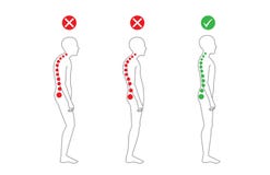 Correct alignment of body in standing posture