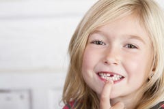 Criança que falta o dente anterior imagens de stock Criança que falta o dente anterior imagens de stock