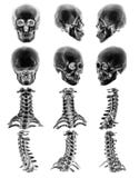 CT scan & x28; Computed tomography & x29; with 3D graphic show normal human skull and cervical spine stock images CT scan & x28; Computed tomography & x29; with 3D graphic show normal human skull and cervical spine stock images