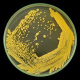 Cultura bacteriana amarela das colônias no prato de petri isolado no preto foto de stock royalty free Cultura bacteriana amarela das colônias no prato de petri isolado no preto foto de stock royalty free