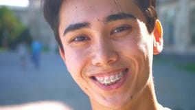 Cute asian man close-up smiling in braces and looking at camera relaxed, chill mood, outside, sunshines