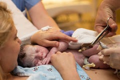 Cutting of the umbilical cord on a newborn baby