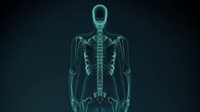 3d ha reso l'illustrazione delle armi dolorose, spalla animazione medica di concetto 3d ha reso l'illustrazione delle armi dolorose, spalla animazione medica di concetto