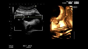 4D high quality ultrasound echography check. Gynecological medical examination. 33 weeks old pregnancy