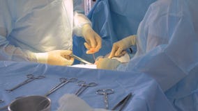 De handen die van het chirurgenteam chirurgie uitvoeren Sluit omhoog stock videobeelden De handen die van het chirurgenteam chirurgie uitvoeren Sluit omhoog stock videobeelden