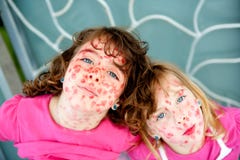 De meisjesellende die van het kind lippenstiftmazelen beweert stock foto De meisjesellende die van het kind lippenstiftmazelen beweert stock foto
