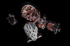 De microscopische parasietentikken, de mijten, Ixodes-scapularis of de herten tikken of blacklegged tik, Dermacentor-reticulatus stock afbeeldingen De microscopische parasietentikken, de mijten, Ixodes-scapularis of de herten tikken of blacklegged tik, Dermacentor-reticulatus stock afbeeldingen