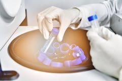 De onderzoeker gebruikt centrifugebuis 15 ml om de laboratoriumtest te doen stock foto's De onderzoeker gebruikt centrifugebuis 15 ml om de laboratoriumtest te doen stock foto's