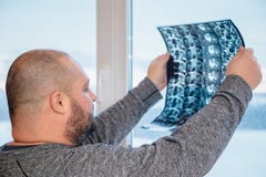 Den feta mannen undersöker resultat av kopiering för magnetisk resonans MRI av hans höftled Selektivt fokusera royaltyfria bilder Den feta mannen undersöker resultat av kopiering för magnetisk resonans MRI av hans höftled Selektivt fokusera royaltyfria bilder