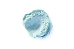 Dental impression model royalty free stock images Dental impression model royalty free stock images