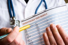 Diagnos i hematology och hematological foto för begrepp för blodprov Doktorn rymmer i hans handresultat av blodprovet och indiker royaltyfria bilder Diagnos i hematology och hematological foto för begrepp för blodprov Doktorn rymmer i hans handresultat av blodprovet och indiker royaltyfria bilder