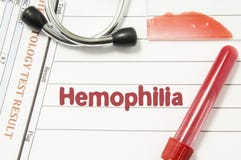 Diagnosis of Hemophilia. Laboratory blood bottle vacutainer, glass slide with blood smear, hematology test, stethoscope lying on stock photography Diagnosis of Hemophilia. Laboratory blood bottle vacutainer, glass slide with blood smear, hematology test, stethoscope lying on stock photography