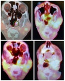 Diagnóstico nuclear de la oncología del cuello de la cabeza del ct del animal doméstico de la medicina fotografía de archivo libre de regalías Diagnóstico nuclear de la oncología del cuello de la cabeza del ct del animal doméstico de la medicina fotografía de archivo libre de regalías