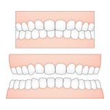 Dirigez l'illustration des dents et des gommes blanches d'une perspective frontale des descriptions médicales et dentaires illustration libre de droits Dirigez l'illustration des dents et des gommes blanches d'une perspective frontale des descriptions médicales et dentaires illustration libre de droits