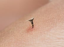 Dirty and strongly acute a sharp thorn plants pierced skin human Royalty Free Stock Image Dirty and strongly acute a sharp thorn plants pierced skin human Royalty Free Stock Image