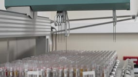 Dispositif robotique automatisé d'examens médicaux, équipement de laboratoire diagnostique clinique banque de vidéos Dispositif robotique automatisé d'examens médicaux, équipement de laboratoire diagnostique clinique banque de vidéos
