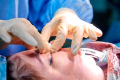 Docteur faisant le rhinoplasty ? la dame Chirurgien palpant le nez patient femelle image stock Docteur faisant le rhinoplasty ? la dame Chirurgien palpant le nez patient femelle image stock