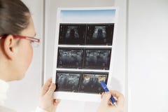 Doctor checking thyroid ultrasound photograph