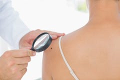 Doctor examining melanoma on woman