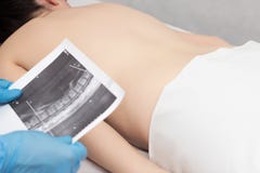 Doctor holds an MRI shot on the back of a girl who has a backache, back problems, neurology, inflammation stock photo Doctor holds an MRI shot on the back of a girl who has a backache, back problems, neurology, inflammation stock photo