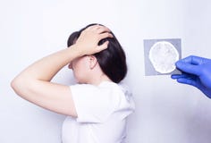 A doctor holds an x-ray of a patient caucasian girl with a headache and brain contusion, diagnosis and treatment of headaches, stock photos A doctor holds an x-ray of a patient caucasian girl with a headache and brain contusion, diagnosis and treatment of headaches, stock photos