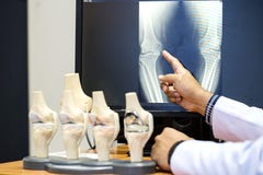 Doctor pointing on the knee problem point on x-ray film. x-ray film show skeleton knee on film. royalty free stock image Doctor pointing on the knee problem point on x-ray film. x-ray film show skeleton knee on film. royalty free stock image
