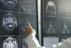 Doctor pointing to brain anatomy on MRI image royalty free stock image Doctor pointing to brain anatomy on MRI image royalty free stock image