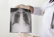 Doctor que examina una radiografía del pulmón Imagen de archivo libre de regalías Doctor que examina una radiografía del pulmón Imagen de archivo libre de regalías