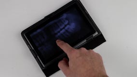Doctor`s fingers zoom in on a human dental x-ray on the tablet screen