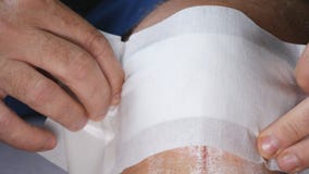 Doktor Applying ein neuer und sauberer Verband auf einer Fuß-Wunde stockfotos Doktor Applying ein neuer und sauberer Verband auf einer Fuß-Wunde stockfotos