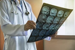 Doutor que guarda o cérebro de MRI no escritório médico imagem de stock Doutor que guarda o cérebro de MRI no escritório médico imagem de stock