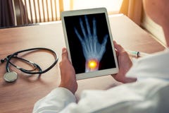 Doutor que guarda uma tabuleta digital com raio X de uma m?o esquerda com dor da osteodistrofia no estetosc?pio do pulso na mesa foto de stock Doutor que guarda uma tabuleta digital com raio X de uma m?o esquerda com dor da osteodistrofia no estetosc?pio do pulso na mesa foto de stock
