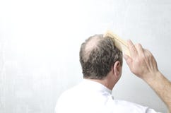 E r Έννοια της απώλειας τρίχας Κενό διάστημα για το κείμενό σας στοκ φωτογραφία E r Έννοια της απώλειας τρίχας Κενό διάστημα για το κείμενό σας στοκ φωτογραφία