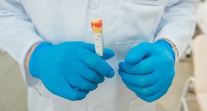 Ein Doktor in den blauen Handschuhen h?lt ein leeres Rohr f?r die Pr?fung lizenzfreies stockbild Ein Doktor in den blauen Handschuhen h?lt ein leeres Rohr f?r die Pr?fung lizenzfreies stockbild
