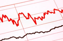 EKG Style Chart Royalty Free Stock Photo EKG Style Chart Royalty Free Stock Photo