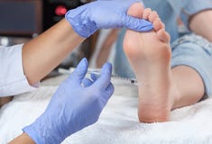 El doctor hace las inyecciones intramusculares del toxinon botulinum los pies foto de archivo El doctor hace las inyecciones intramusculares del toxinon botulinum los pies foto de archivo