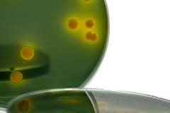 El primer para las bacterias de la placa cultiva crecimiento en medios selectivos imágenes de archivo libres de regalías El primer para las bacterias de la placa cultiva crecimiento en medios selectivos imágenes de archivo libres de regalías