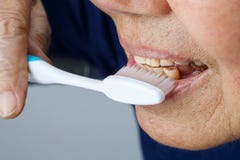 Elderly tooth attrition royalty free stock photos Elderly tooth attrition royalty free stock photos