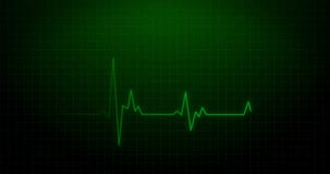 Electrocardiogram EKG Heartbeat Recording of Death or Dying - Green Healthcare Monitor Animated 4k Rendered Footage. Stock Footage - Video of background, equipment: 97308910 Electrocardiogram EKG Heartbeat Recording of Death or Dying - Green Healthcare Monitor Animated 4k Rendered Footage. Stock Footage - Video of background, equipment: 97308910