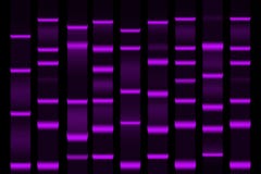 Electrophoretogram de la separación de la electroforesis del gel ilustración del vector Electrophoretogram de la separación de la electroforesis del gel ilustración del vector