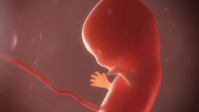 Embryo timelapse of born