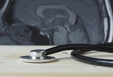 En svart stetoskop och MRI-hjärnbild royaltyfria bilder En svart stetoskop och MRI-hjärnbild royaltyfria bilder